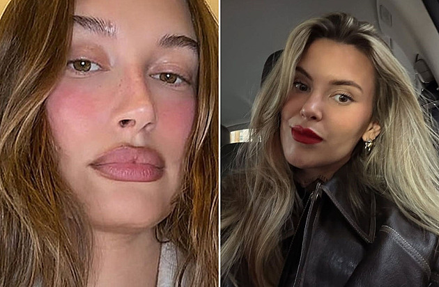 Zvětšené rty u slavných žen: Kdo omládl a komu zákrok spíš uškodil?