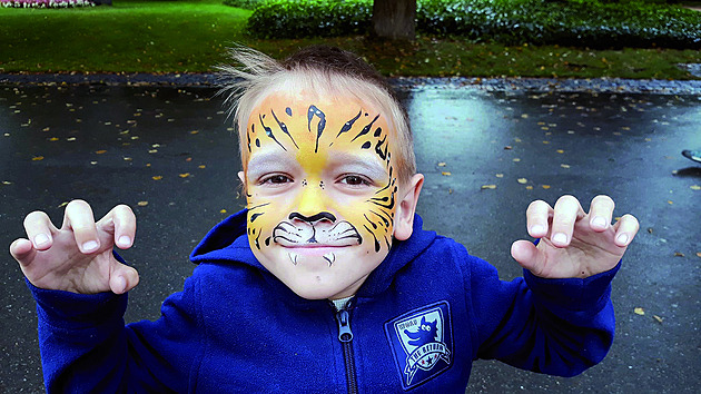 Vážně nemocný chlapec podstupuje průlomovou léčbu. Chci být youtuber, přeje si