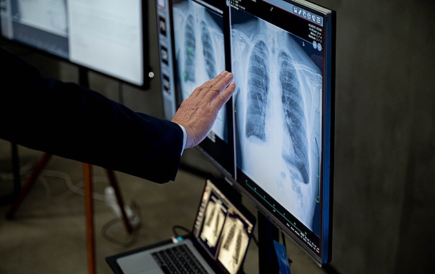 Dvě třetiny nemocnic využívají umělou inteligenci, Vojtěch chystá novou strategii