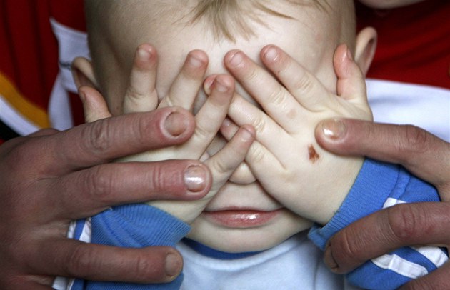 Zlomené ruce i nohy, tělo samá podlitina. Týrání batolete otřáslo kriminalisty